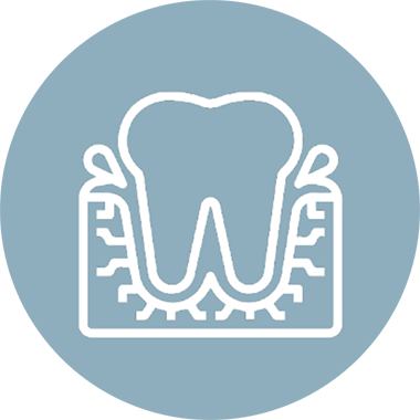 Bleeding Gums