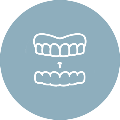 Clear Aligners