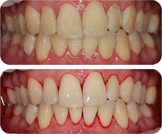 EMS before and after 3