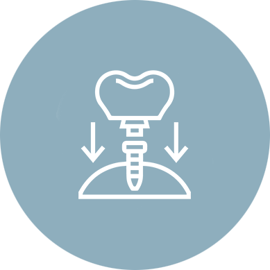 Endodontic Care (Root Canals)