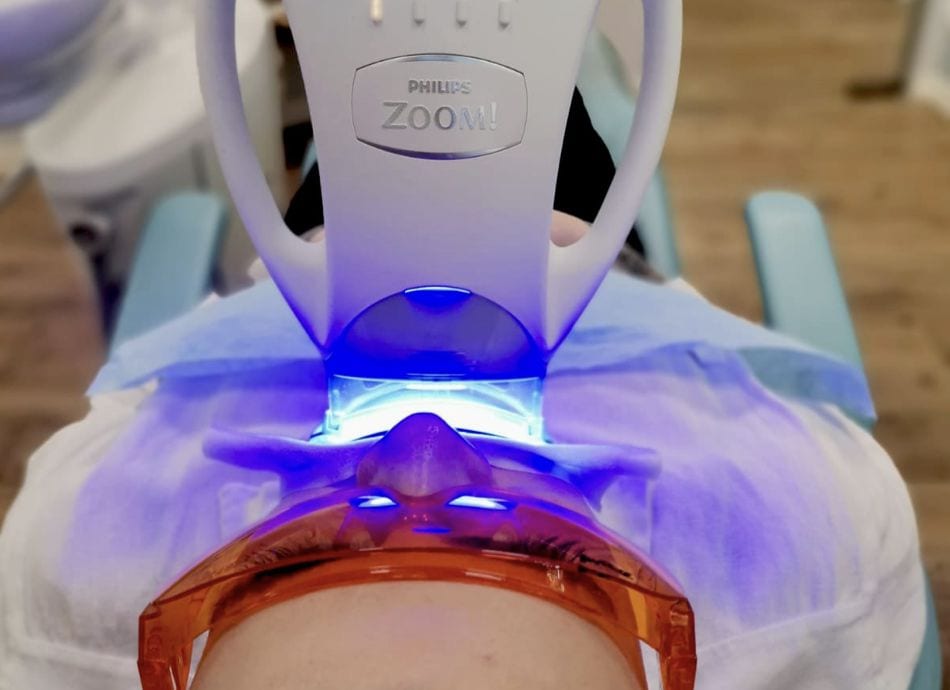 In chair teeth whitening