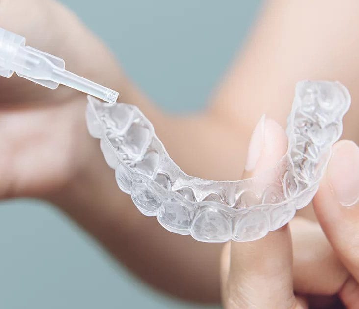 Take-home teeth whitening kit