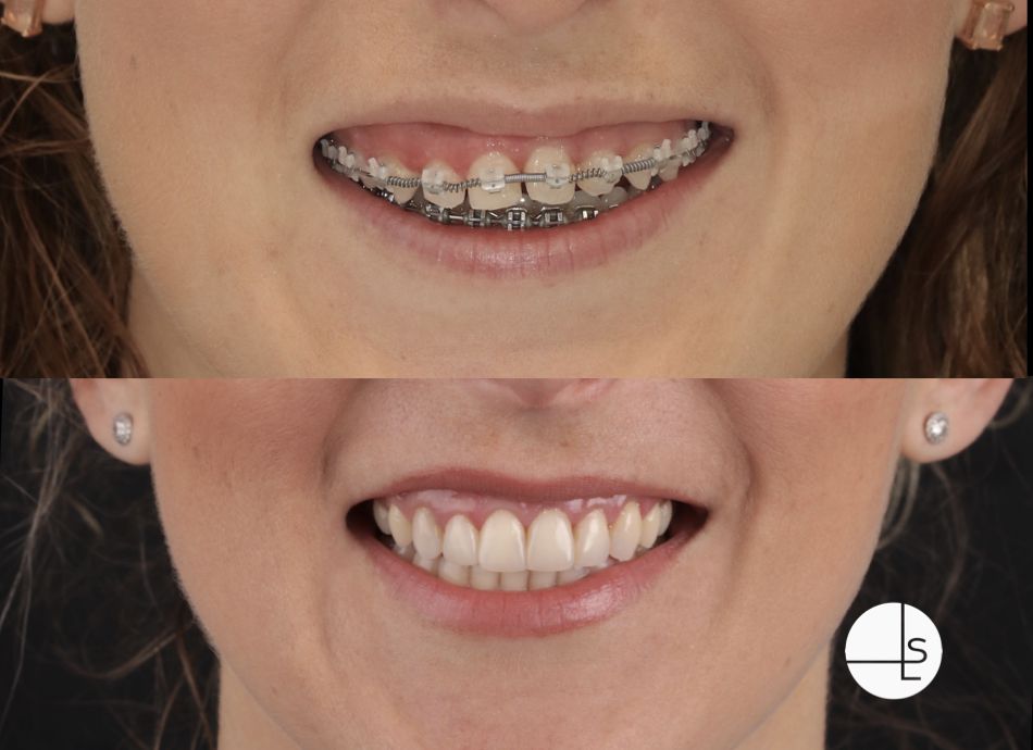 Advanced Orthodontics Advanced Orthodontics