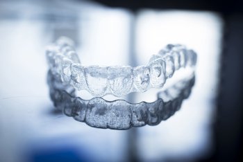 Invisalign Costs